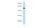 Protein Zfp874b antibody, A30347, Boster Biological Technology, Western Blot image 