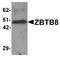 Zinc Finger And BTB Domain Containing 8A antibody, A12536, Boster Biological Technology, Western Blot image 