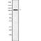 Apolipoprotein B Receptor antibody, abx148244, Abbexa, Western Blot image 