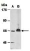 Solute Carrier Family 11 Member 1 antibody, orb66774, Biorbyt, Western Blot image 
