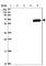 Zinc Finger Protein 555 antibody, HPA053956, Atlas Antibodies, Western Blot image 