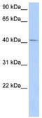 General Transcription Factor IIH Subunit 4 antibody, TA329687, Origene, Western Blot image 