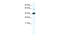 RELB Proto-Oncogene, NF-KB Subunit antibody, 28-593, ProSci, Enzyme Linked Immunosorbent Assay image 