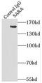 Secretion Associated Ras Related GTPase 1A antibody, FNab07606, FineTest, Immunoprecipitation image 