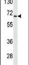 Alanine--Glyoxylate Aminotransferase 2 antibody, PA5-26833, Invitrogen Antibodies, Western Blot image 