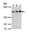 Rho Associated Coiled-Coil Containing Protein Kinase 1 antibody, orb74188, Biorbyt, Western Blot image 