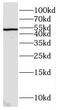 CWC25 Spliceosome Associated Protein Homolog antibody, FNab02086, FineTest, Western Blot image 