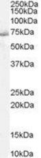 Protein Tyrosine Phosphatase Non-Receptor Type 11 antibody, GTX29214, GeneTex, Western Blot image 