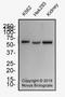 WT1 Transcription Factor antibody, NB110-60011, Novus Biologicals, Western Blot image 