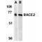 Beta-Secretase 2 antibody, PA1-30765, Invitrogen Antibodies, Western Blot image 