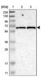 Intermediate Filament Family Orphan 2 antibody, PA5-53406, Invitrogen Antibodies, Western Blot image 