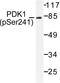 3-phosphoinositide-dependent protein kinase 1 antibody, LS-C177940, Lifespan Biosciences, Western Blot image 