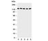 Desmoglein-2 antibody, R30636, NSJ Bioreagents, Western Blot image 