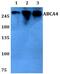 Retinal-specific ATP-binding cassette transporter antibody, PA5-75820, Invitrogen Antibodies, Western Blot image 