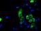 Protein-lysine 6-oxidase antibody, GTX84182, GeneTex, Immunofluorescence image 