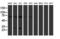 Biogenesis Of Lysosomal Organelles Complex 1 Subunit 6 antibody, M09981, Boster Biological Technology, Western Blot image 