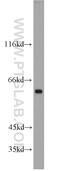 Sequestosome 1 antibody, 55274-1-AP, Proteintech Group, Western Blot image 