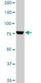 Phosphoinositide-3-Kinase Regulatory Subunit 1 antibody, H00005295-M01, Novus Biologicals, Western Blot image 