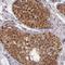 TATA-Box Binding Protein Associated Factor 7 Like antibody, NBP1-84350, Novus Biologicals, Immunohistochemistry frozen image 