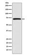 Baculoviral IAP Repeat Containing 2 antibody, M01700, Boster Biological Technology, Western Blot image 