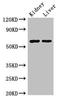 Aldehyde Dehydrogenase 6 Family Member A1 antibody, orb47279, Biorbyt, Western Blot image 