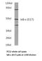 NFKB Inhibitor Epsilon antibody, LS-C176084, Lifespan Biosciences, Western Blot image 