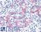 Melanoma Cell Adhesion Molecule antibody, LS-B4050, Lifespan Biosciences, Immunohistochemistry paraffin image 