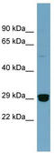 High Mobility Group Box 2 antibody, TA344431, Origene, Western Blot image 