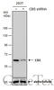 Cystathionine-Beta-Synthase antibody, GTX628777, GeneTex, Western Blot image 