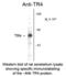 Nuclear Receptor Subfamily 2 Group C Member 2 antibody, 50-147, ProSci, Western Blot image 