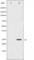 Troponin I3, Cardiac Type antibody, abx012285, Abbexa, Western Blot image 