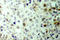 Cyclin Dependent Kinase 1 antibody, LS-C177883, Lifespan Biosciences, Immunohistochemistry paraffin image 