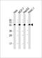 Prolyl 4-Hydroxylase Subunit Beta antibody, MBS9216874, MyBioSource, Western Blot image 