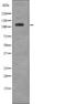 EPH Receptor A6 antibody, PA5-64787, Invitrogen Antibodies, Western Blot image 