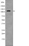 EPH Receptor A6 antibody, PA5-64787, Invitrogen Antibodies, Western Blot image 