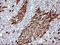 Indoleamine 2,3-Dioxygenase 1 antibody, M01705-3, Boster Biological Technology, Immunohistochemistry paraffin image 