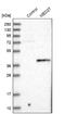 Mediator Complex Subunit 27 antibody, NBP1-84377, Novus Biologicals, Western Blot image 