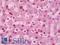 Cell Death Inducing DFFA Like Effector A antibody, LS-B10551, Lifespan Biosciences, Immunohistochemistry paraffin image 