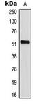 CD2 Cytoplasmic Tail Binding Protein 2 antibody, LS-C354147, Lifespan Biosciences, Western Blot image 