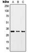 Zinc Finger CCCH-Type Containing 8 antibody, LS-C353590, Lifespan Biosciences, Western Blot image 