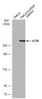 ATM Serine/Threonine Kinase antibody, GTX70107, GeneTex, Western Blot image 