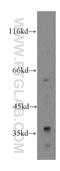 Glycerol-3-Phosphate Dehydrogenase 1 antibody, 13451-1-AP, Proteintech Group, Western Blot image 