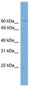 Tubulin Polymerization Promoting Protein Family Member 3 antibody, TA344121, Origene, Western Blot image 