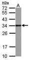 Proteasome activator complex subunit 3 antibody, PA5-21789, Invitrogen Antibodies, Western Blot image 