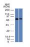 Endoglin antibody, M02997, Boster Biological Technology, Western Blot image 