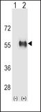 Aldehyde Dehydrogenase 3 Family Member B1 antibody, LS-C156263, Lifespan Biosciences, Western Blot image 