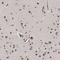 Tumor Protein P53 Inducible Nuclear Protein 1 antibody, NBP1-85108, Novus Biologicals, Immunohistochemistry paraffin image 