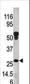Hydroxysteroid 17-Beta Dehydrogenase 10 antibody, LS-C100051, Lifespan Biosciences, Western Blot image 