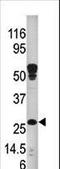 3-hydroxyacyl-CoA dehydrogenase type-2 antibody, LS-C100051, Lifespan Biosciences, Western Blot image 