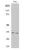 Mitochondrial Ribosomal Protein L19 antibody, STJ94213, St John